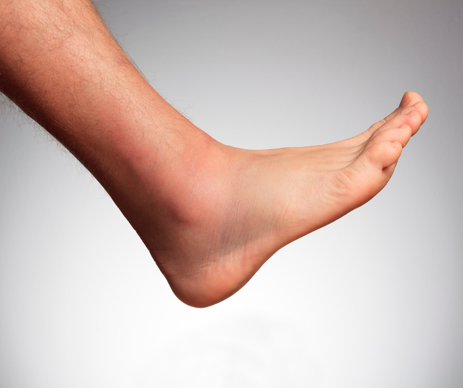 Diabetic Foot Problems- Risks and Precautions
