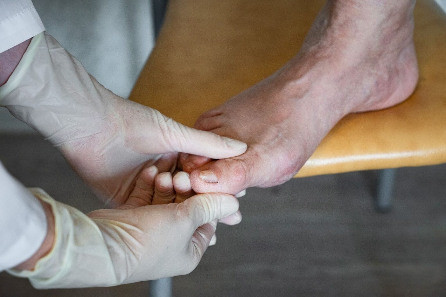 Diabetes and Your Feet: Why Spring Is the Perfect Time for a Foot Check ...